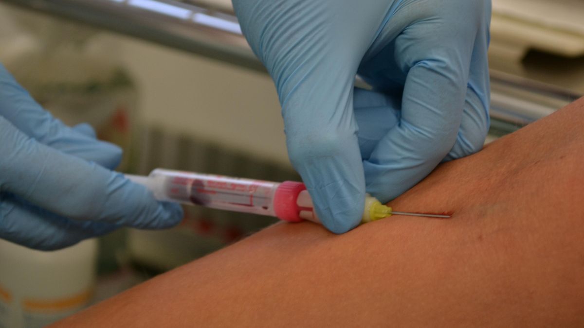 Žloutenka se přesunuje z Prahy a středních Čech na Moravu, kde zemřel 41letý muž